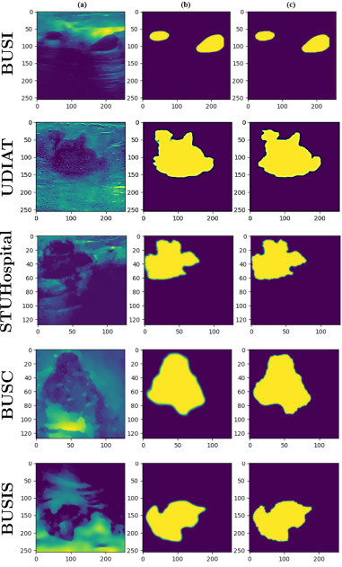 Breastcare screenshot